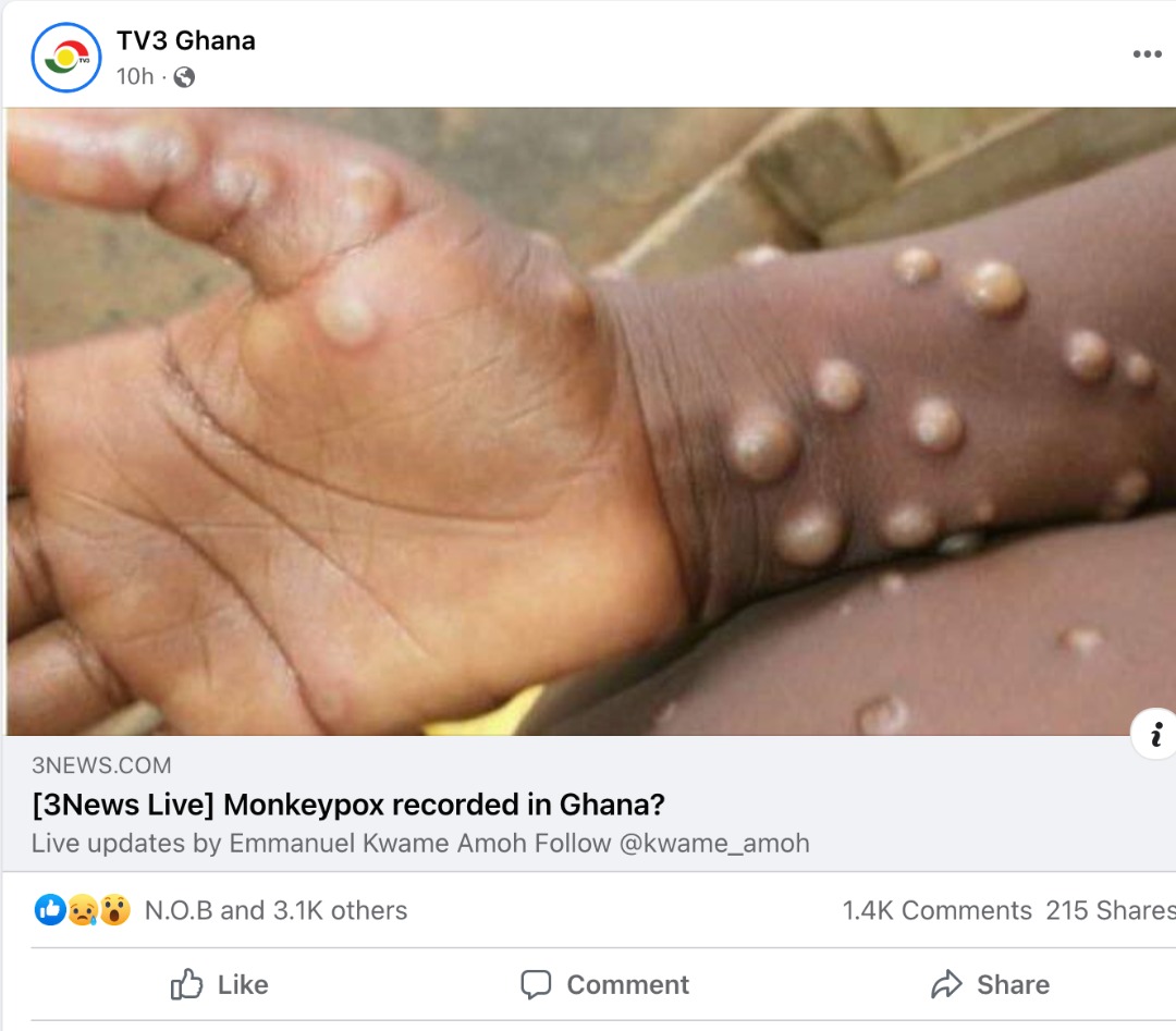 FACT-CHECK: Ghana has NOT recorded a case of Monkeypox