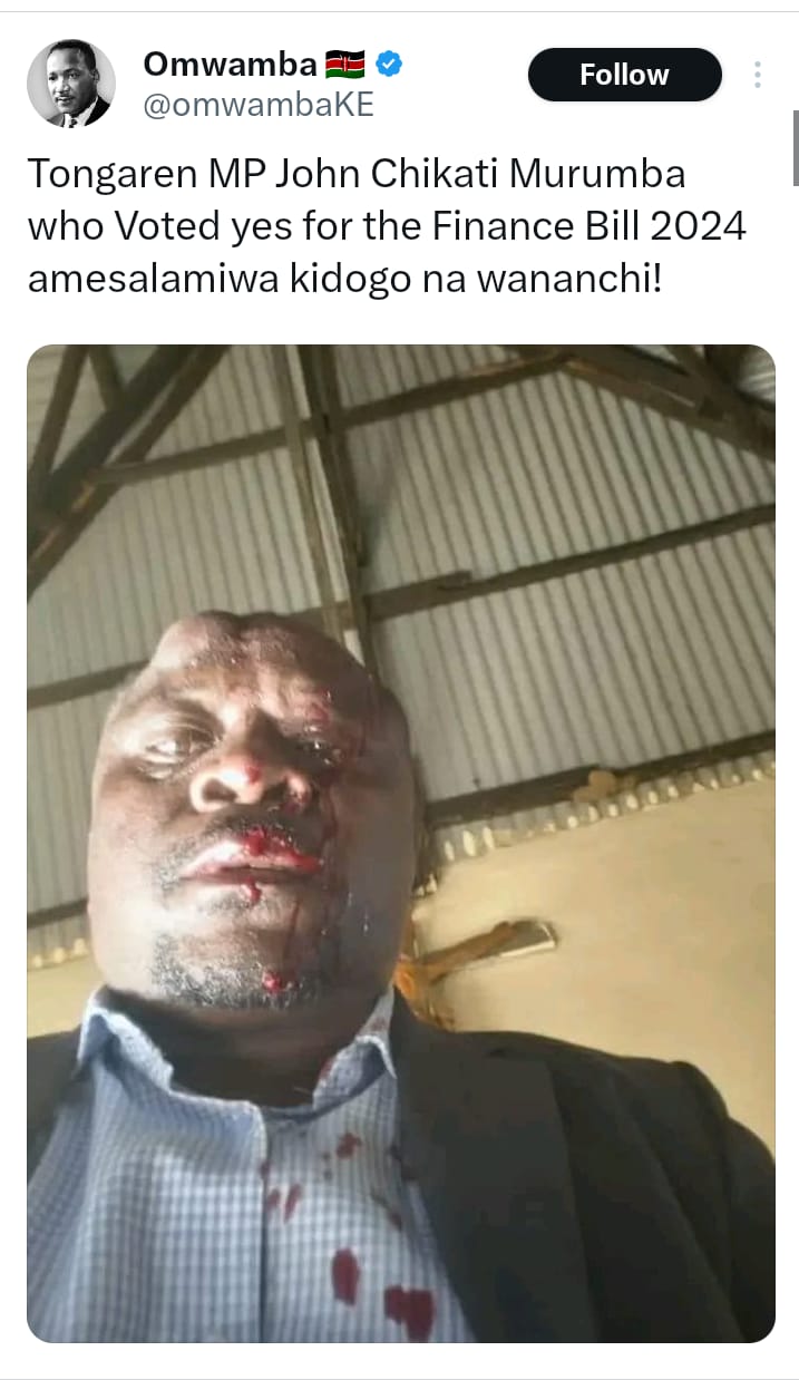 MISLEADING! A viral photo of bloodied-face MP is not from Kenya