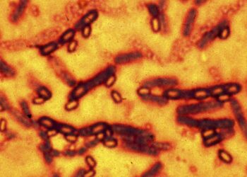 A microscopic picture of spores and vegetative cells of Bacillus anthracis which causes the disease anthrax is pictured in this undated file photograph. As many as 75 scientists working in U.S. federal government laboratories in Atlanta may have been exposed to live anthrax bacteria and are being offered treatment to prevent infection from the deadly organism, the U.S. Centers for Disease Control and Prevention said on June 19, 2014.  REUTERS/Files  (UNITED STATES - Tags: HEALTH DISASTER)