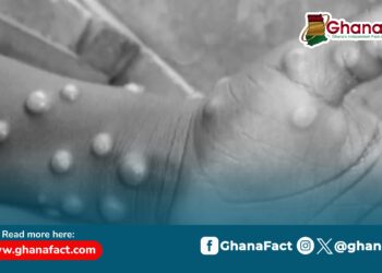 False! Recent Mpox death is not the first since June 2022 